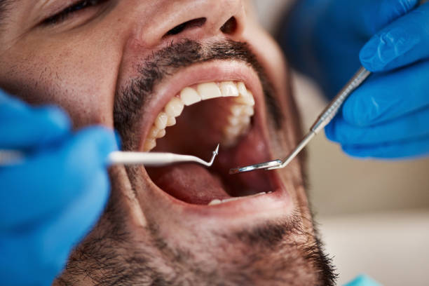 Best Broken or Cracked Tooth Emergency Dentist in Greilickville, MI
