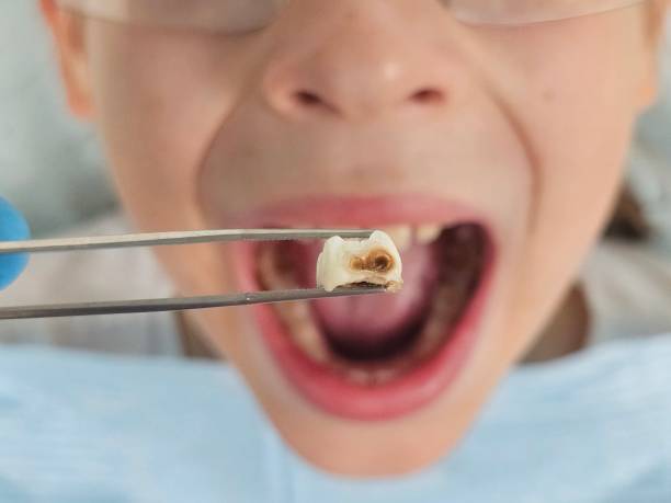 Best Emergency Dental Services for Seniors in Greilickville, MI