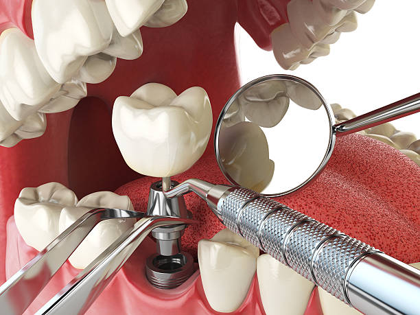 Best Weekend Emergency Dentist in Greilickville, MI