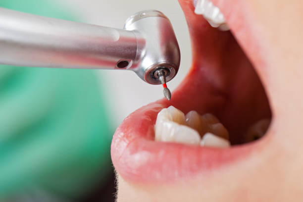 Best Emergency Root Canal Treatment in Greilickville, MI